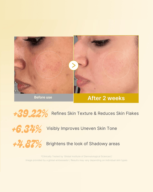 Kojic Acid & Turmeric Toner