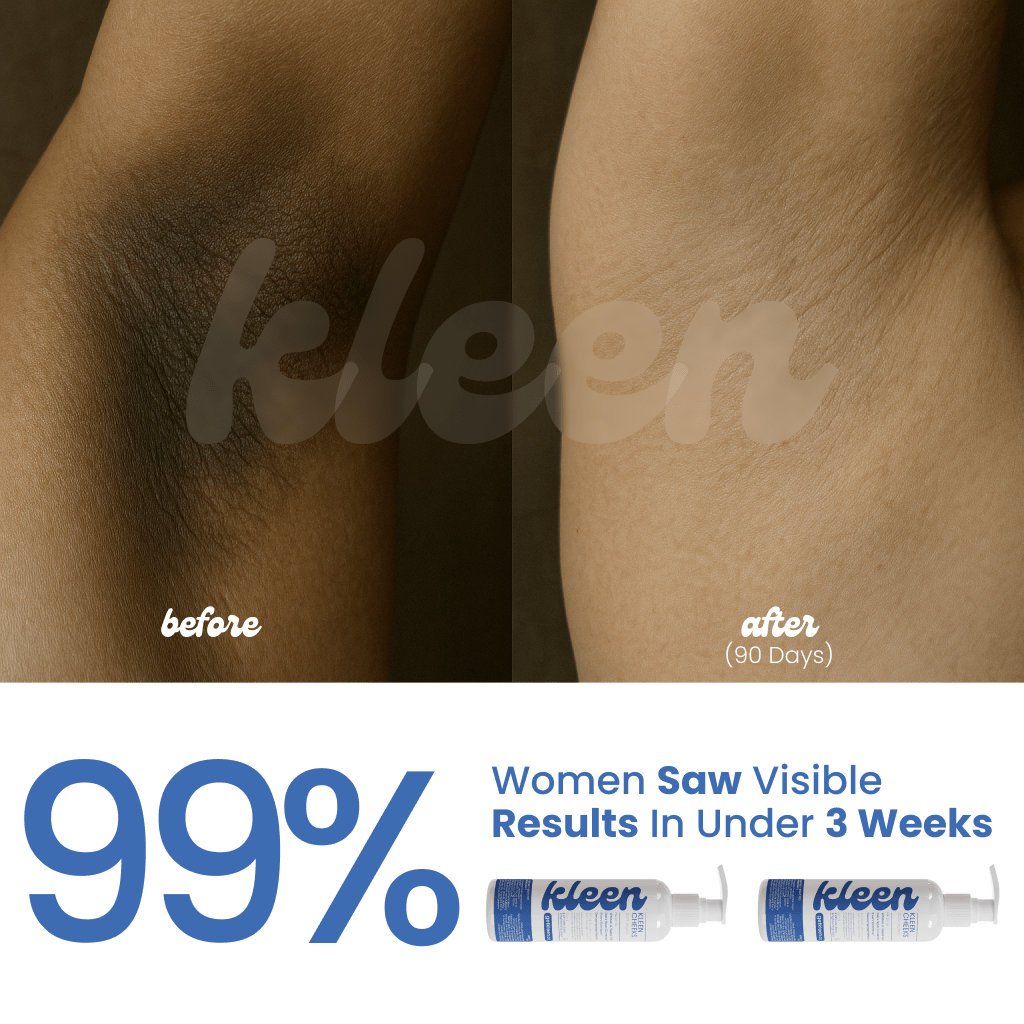 Kleen Cheeks™ - All Body Brightening Lotion