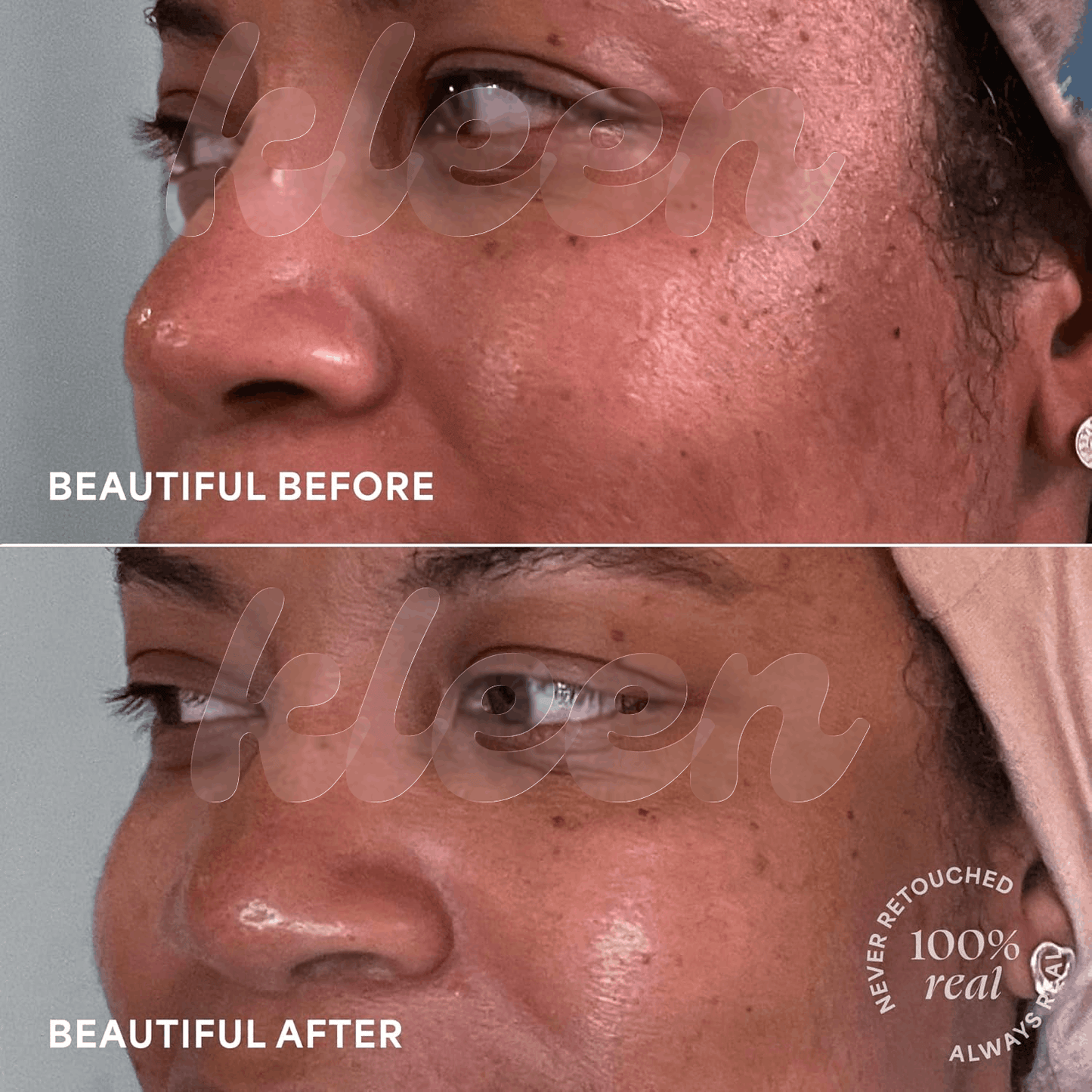 Kleen Brightening Body Toner